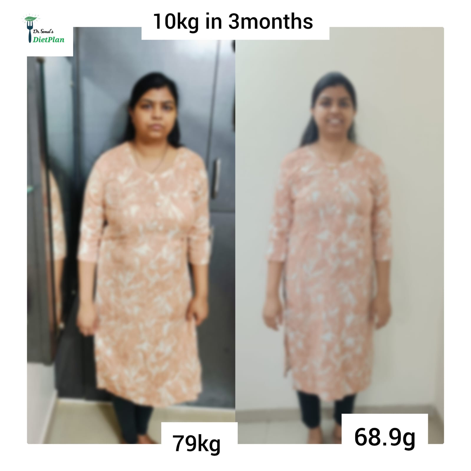 A Life-Changing Weight Loss Journey with Dr. Sonal’s Diet Plan